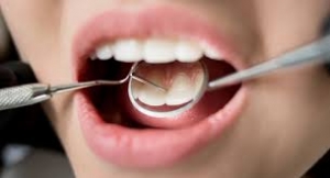 Hide your dental flaws with veneers